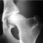 radiografie bazin caine