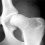 radiografie bazin